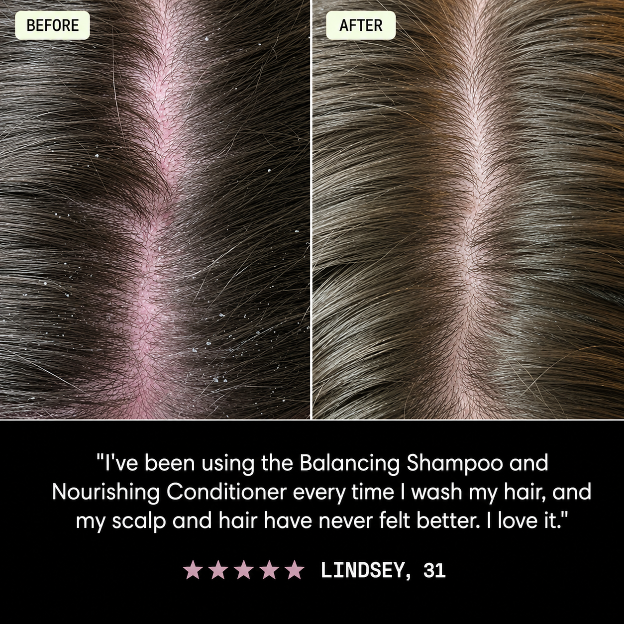 SHAMPOO