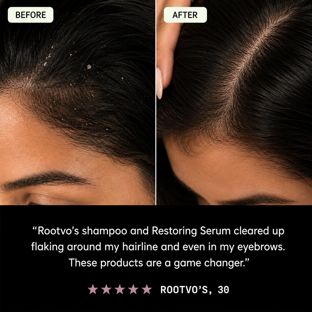 SHAMPOO